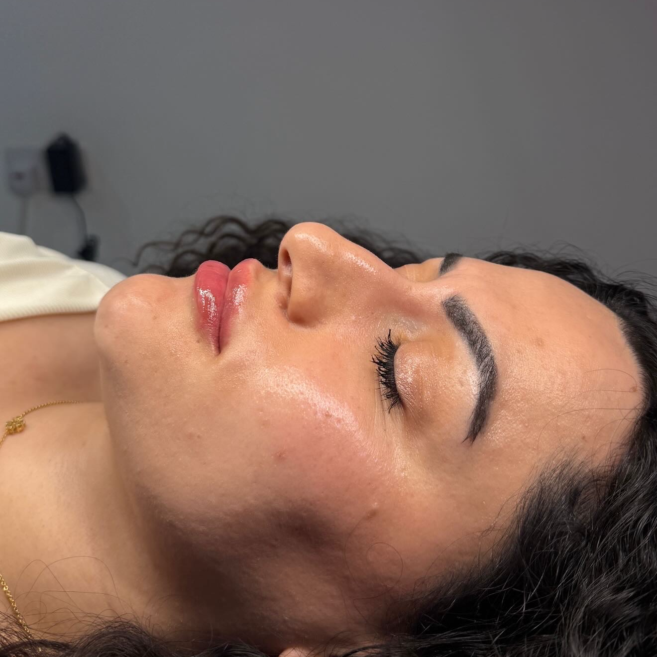 Russian / Natural Lip Filler