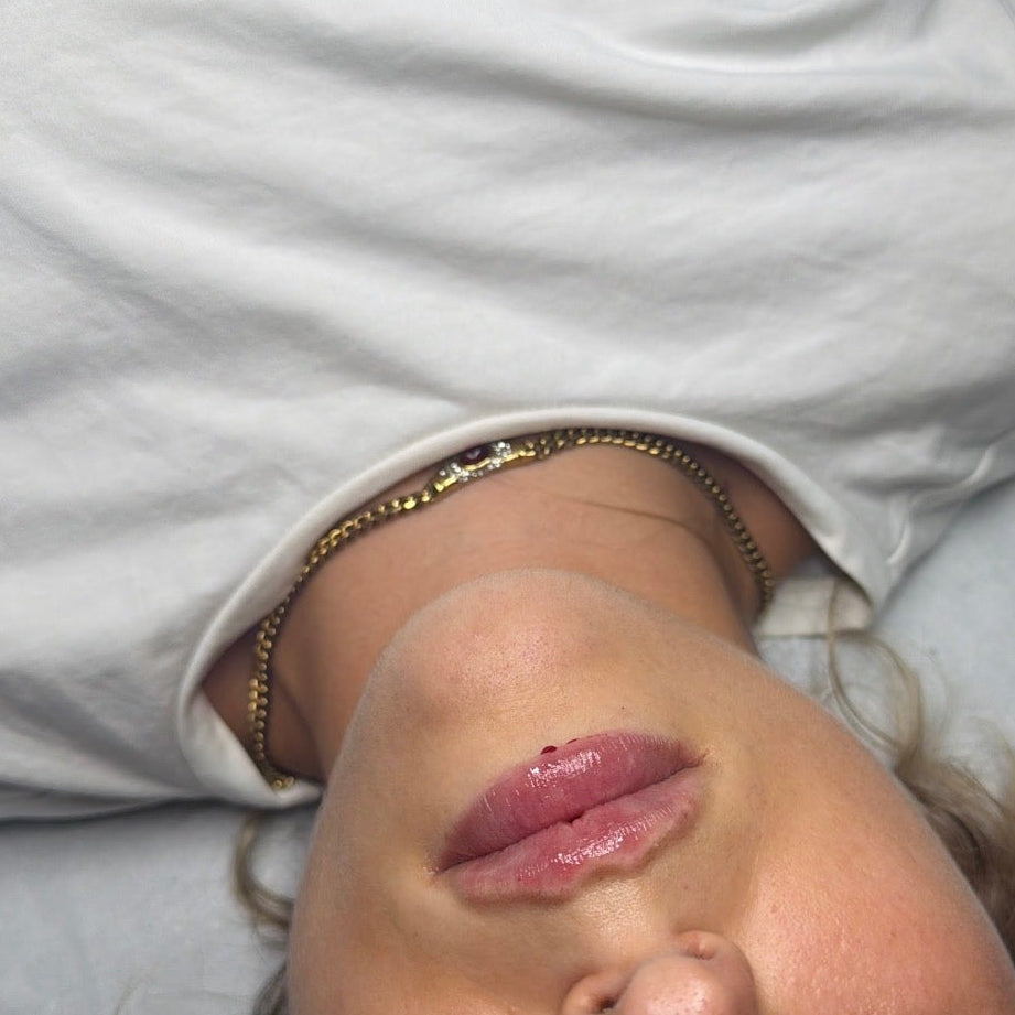 Russian / Natural Lip Filler